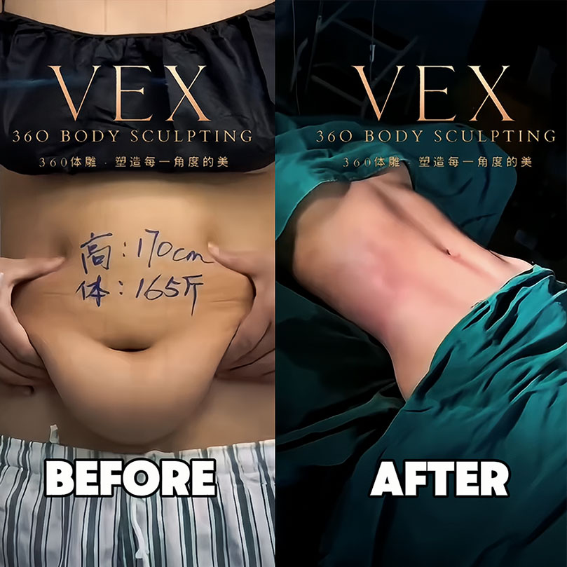 Can a plus-size girl weighing 82.5kg really get V-line abs?