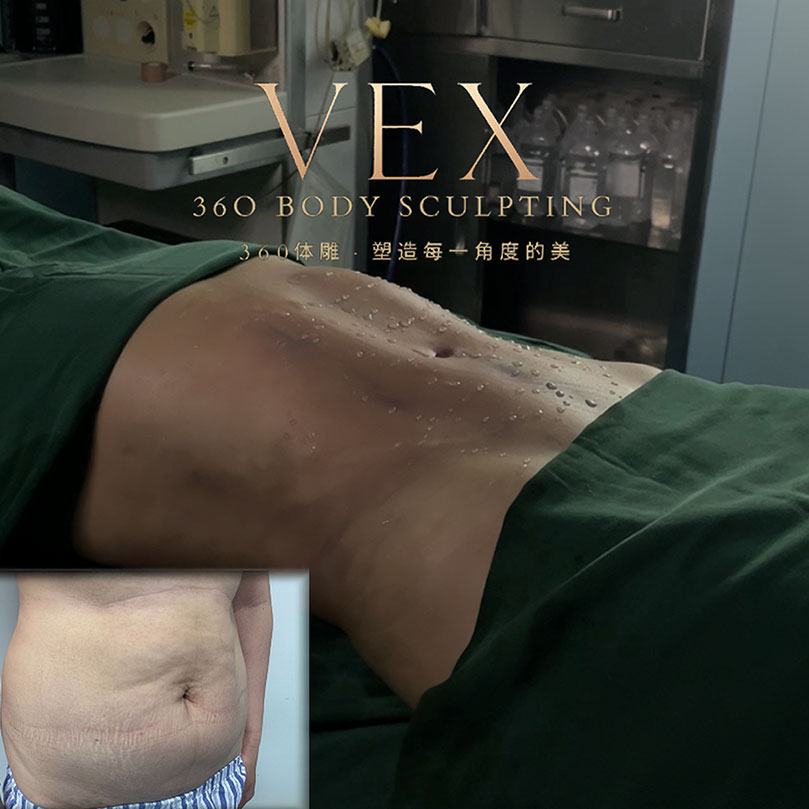 From Australia to Shanghai – one girl's 83.5kg transformation story.