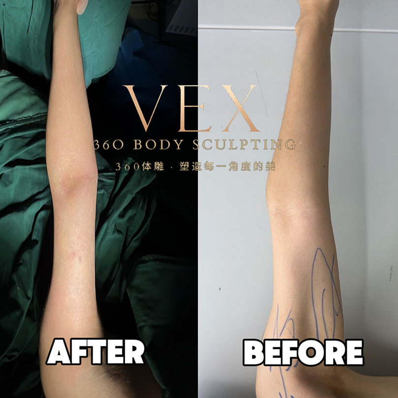 Real recording: A girl's thick arm transformation journey.